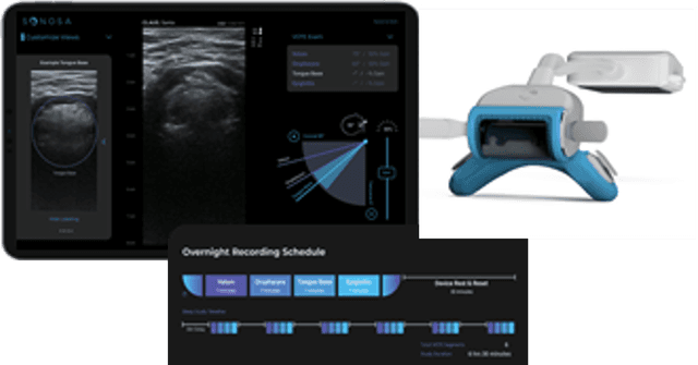 Sonosa Medical ApneaView device